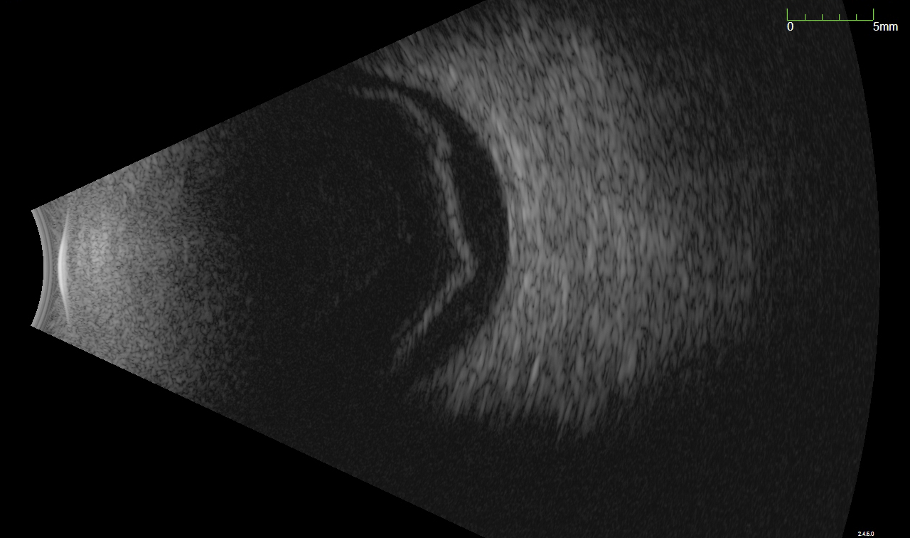 Eye Disease Diagnostic Tests Hawaii Retina Consultants